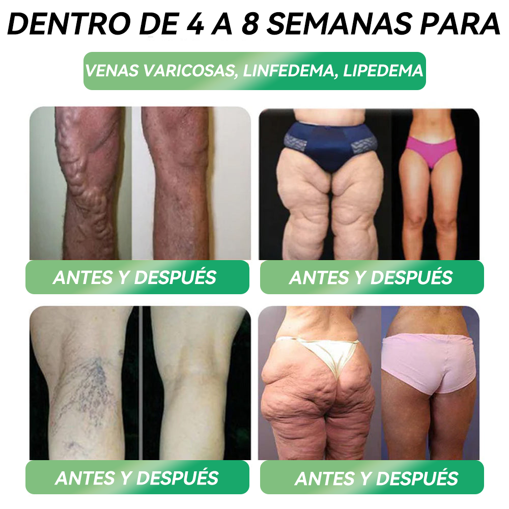 (HHVB®) ¡Solo quedan 6 cajas! ¡Hoy obtén un 30% de descuento adicional! La Solución Oral GLP-1 está clínicamente comprobada para ayudar a controlar el peso y el azúcar en sangre, con resultados duraderos en tan solo 4 a 6 cajas.